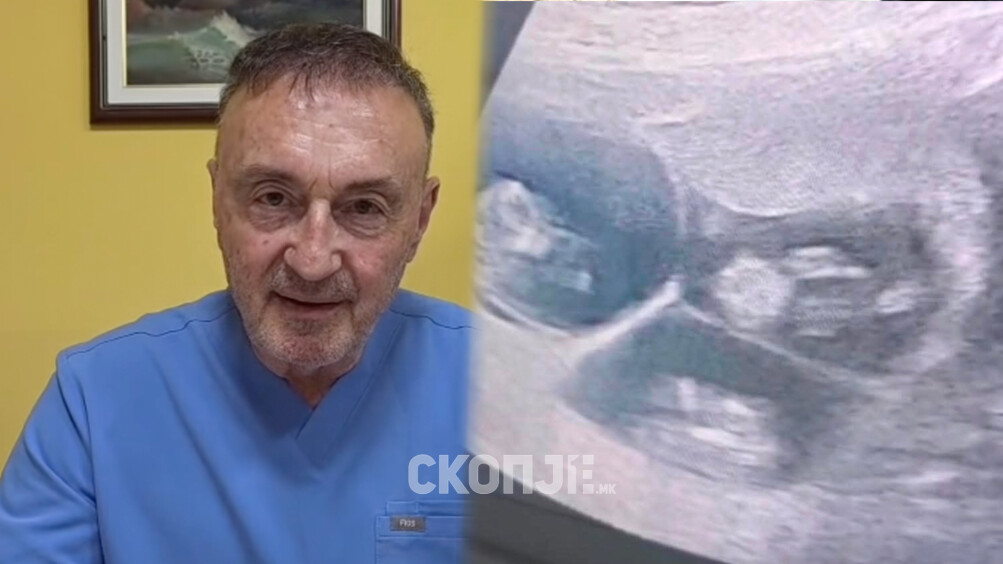 Д-р Трпчевски откри редок случај: Жена на 58 години остана бремена со тројка по ин витро оплодување
